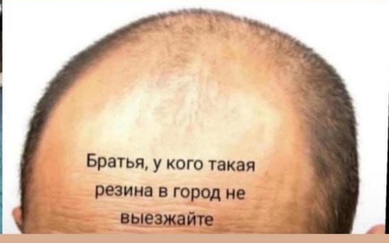 Братья, у кого такая резина в город не выезжайте