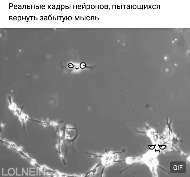 Реальные кадры нейронов пытающихся вернуть забытую мысль