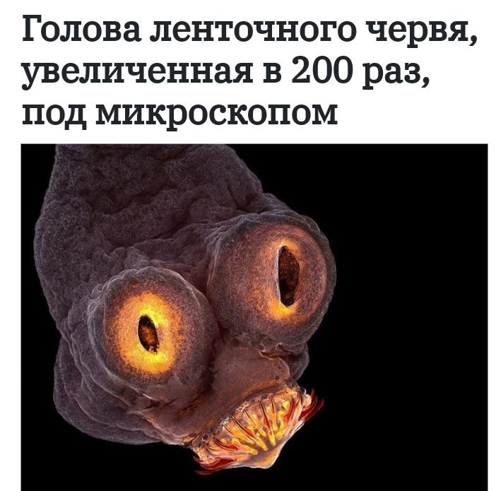 Голова ленточного червя увеличенная в 200 раз ПОД МИКРОСКОПОМ д