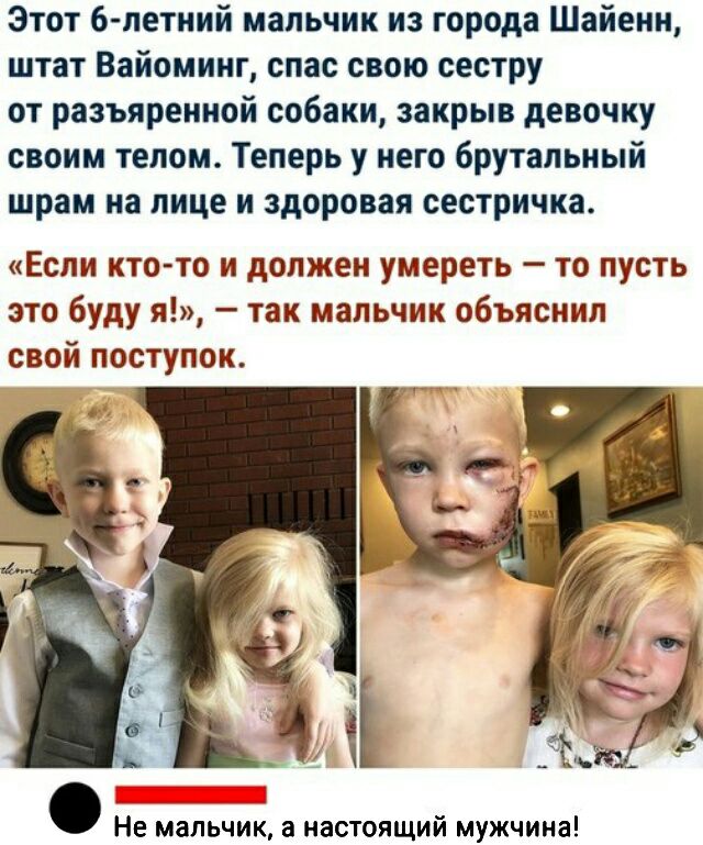 Этот 6 летиий мальчик из города Шайенн штат Вайоминг спас свою сестру от разъярениой собаки закрыв девочку своим телом Теперь у него брутальный шрам на лице и здоровая сестричка Если ктото и должен умереть то пусть это буду я так мальчик объяснил свой поступок Не мальчик а настоящий мужчина
