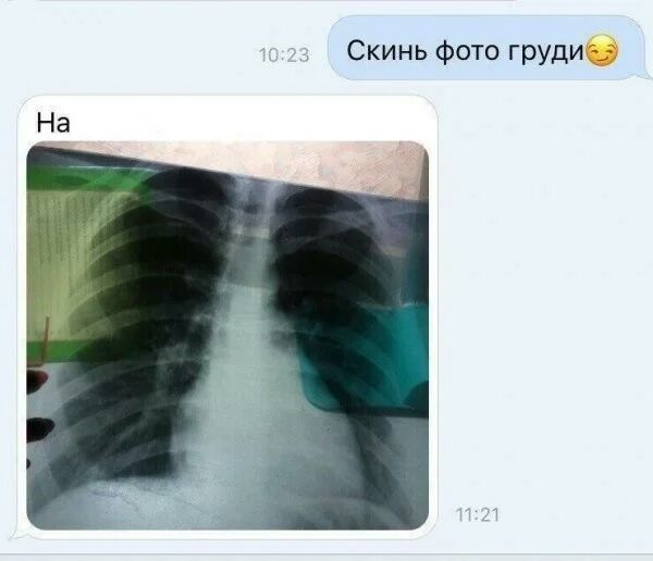 Скинь фото груди