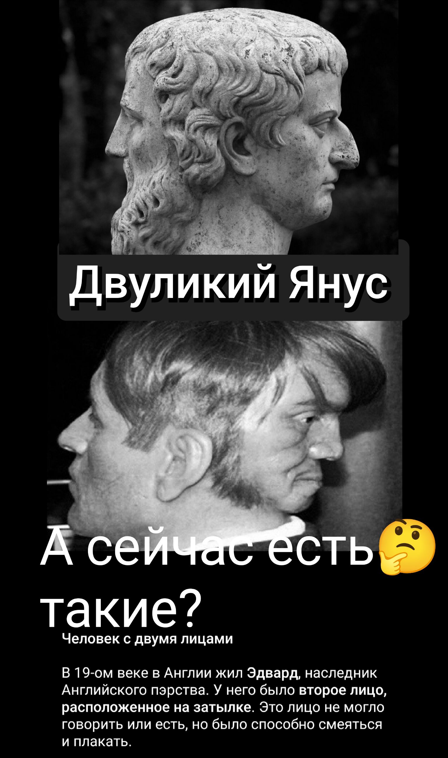 сть такие Человек с двумя лицами В 19 ом веке в Англии жил Эдвард наследник Английского пэрства У него было второе лицо расположенное на затылке Это лицо не могло говорить или есть но было способно смеяться и плакать