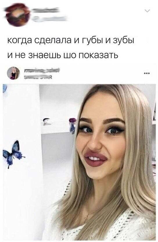 когда сделала и губы и зубы и не знаешь шо показать