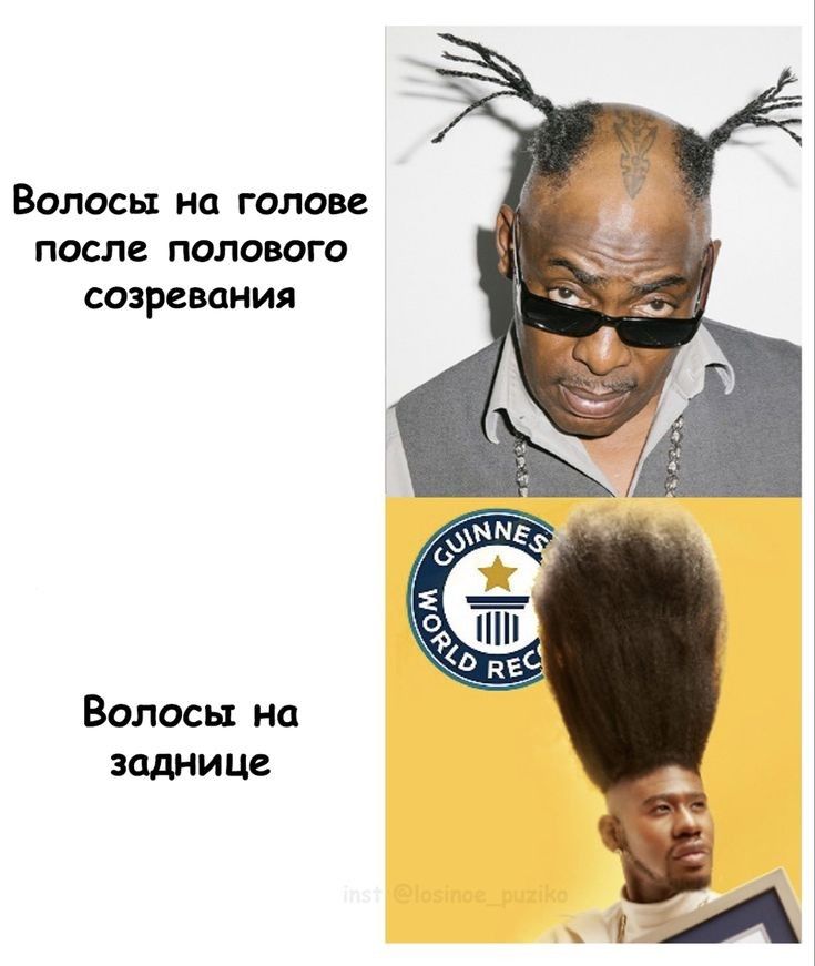 Волосы на голове после полового созревания Волосы на ЗОДНИЦе