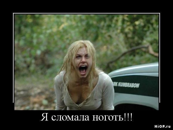 Я сломала ногу!!!