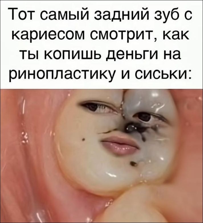 Тот самый задний зуб с кариесом смотрит, как ты копишь деньги на ринопластику и сиcки:
