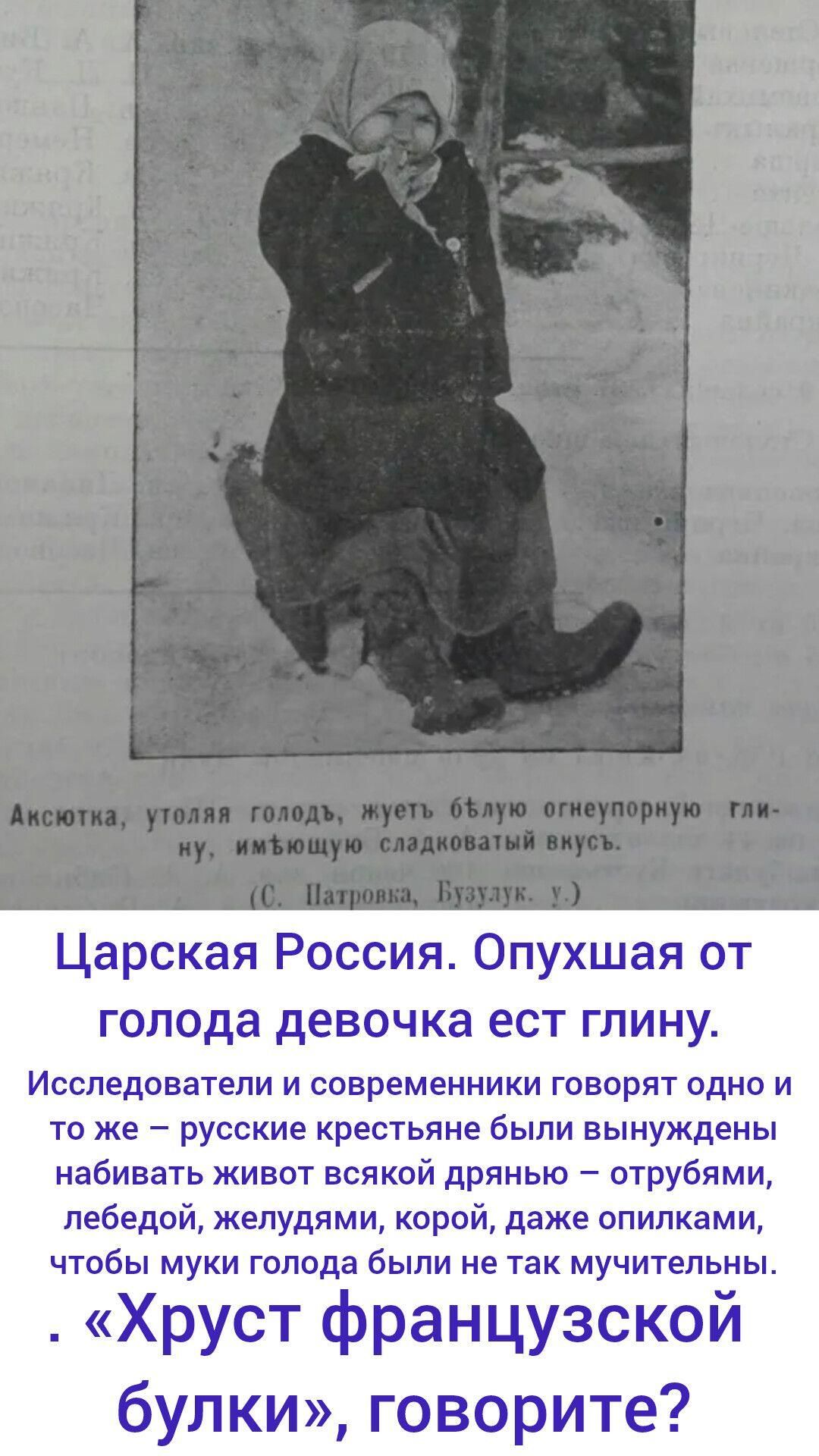 Царская Россия. Опухшая от голода девочка ест глину.