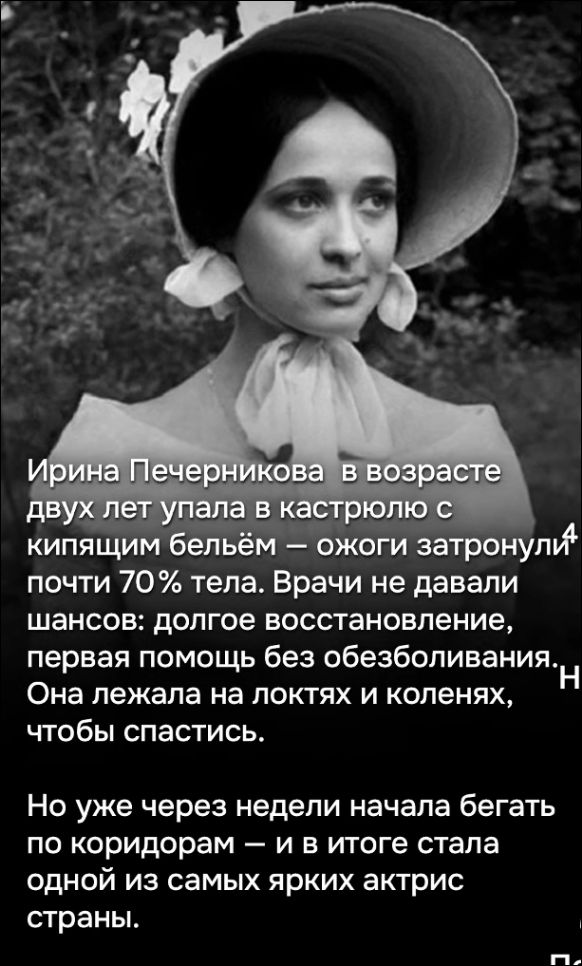 Ирина Печерникова в возрасте двух лет упала в кастрюлю с кипящим бельём — ожоги затронули почти 70% тела. Врачи не давали шансов: долгие восстановление, первая помощь без обезболивания. Она лежала на локтях и коленях, чтобы спастись.
Но уже через недели начала бегать по коридорам — и в итоге стала одной из самых ярких актрис страны.