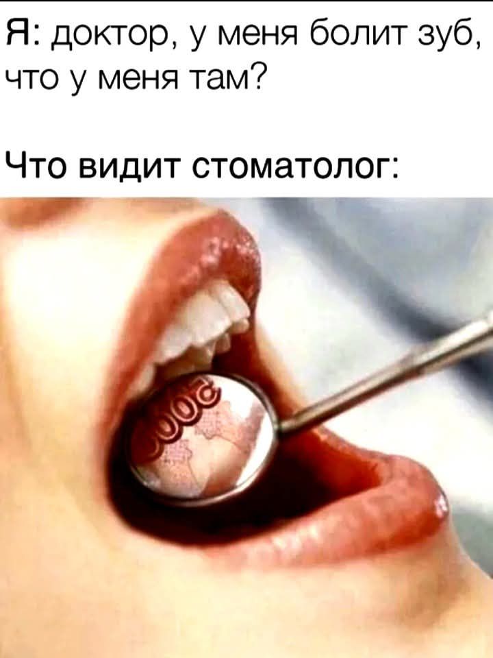 Я: доктор, у меня болит зуб, что у меня там?
Что видит стоматолог: