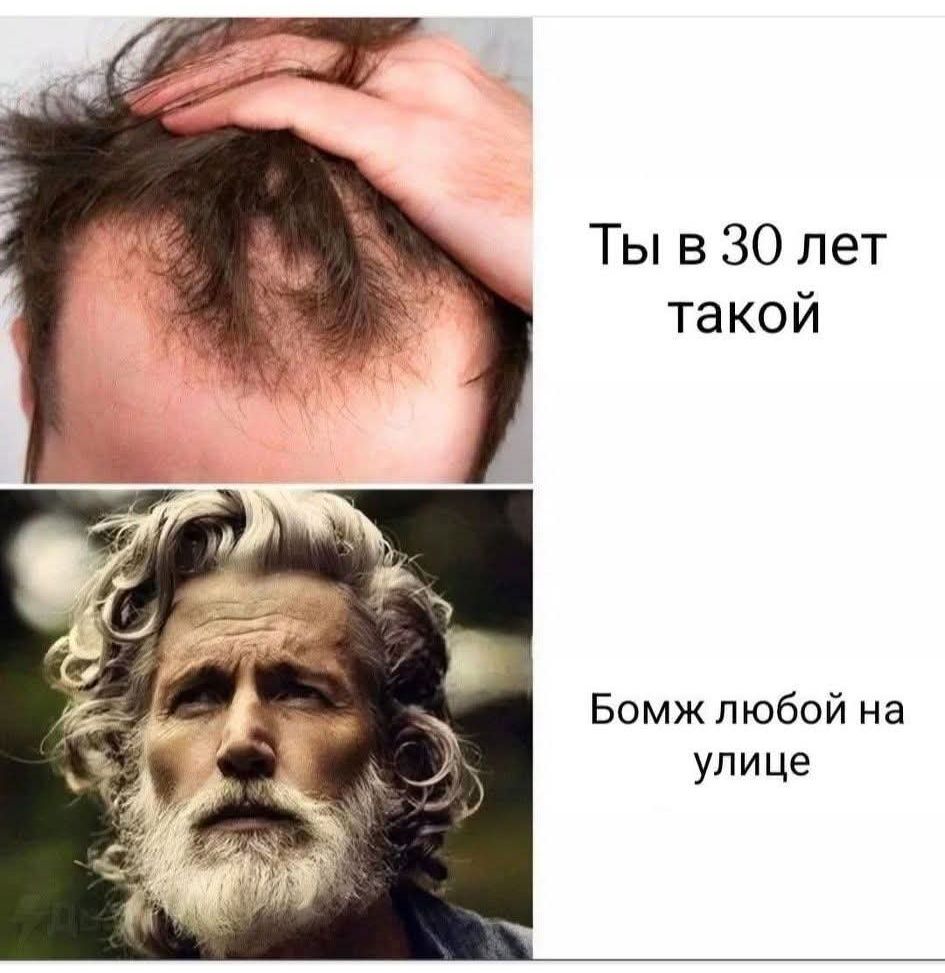 Ты в 30 лет такой\nБомж любой на улице