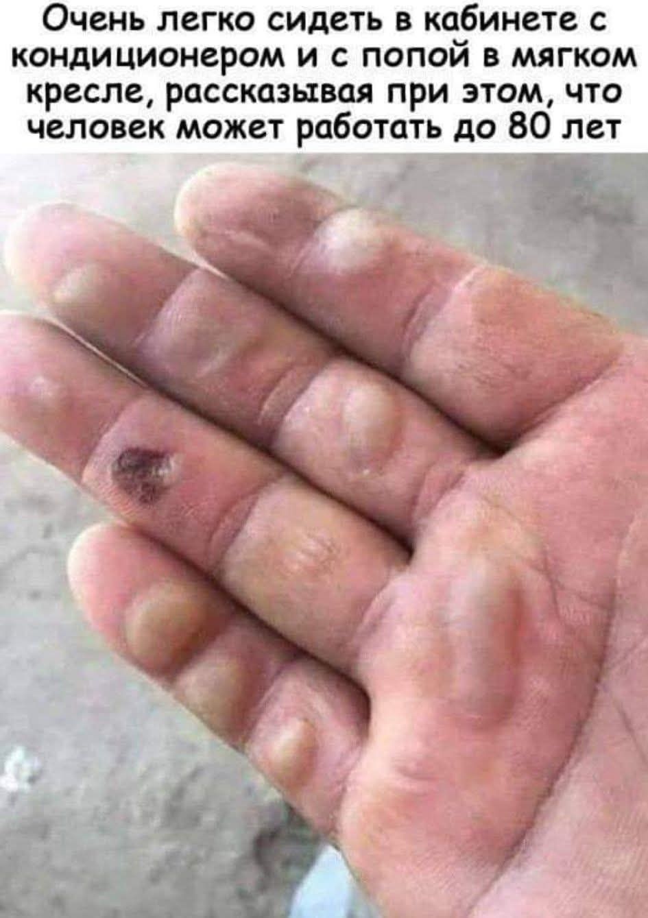Очень легко сидеть в кабинете с кондиционером и с попой в мягком кресле, рассказывая при этом, что человек может работать до 80 лет