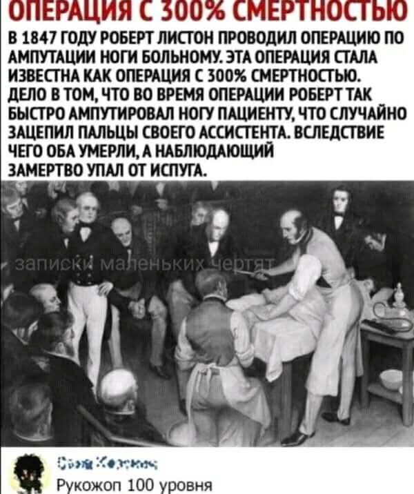ОПЕРАЦИЯ С 300% СМЕРТНОСТЬЮ
В 1847 году Роберт Листон проводил операцию по ампутации ноги больному. Эта операция стала известна как операция с 300% смертностью. Дело в том, что во время операции Роберт так быстро ампутировал ногу пациента, что случайно зацепил пальцы своего ассистента. Вследствие чего оба умерли, а наблюдающий замертво упал от испуга.