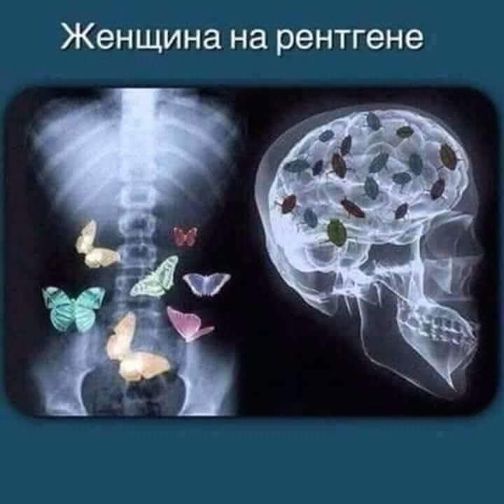 Женщина на рентгене
