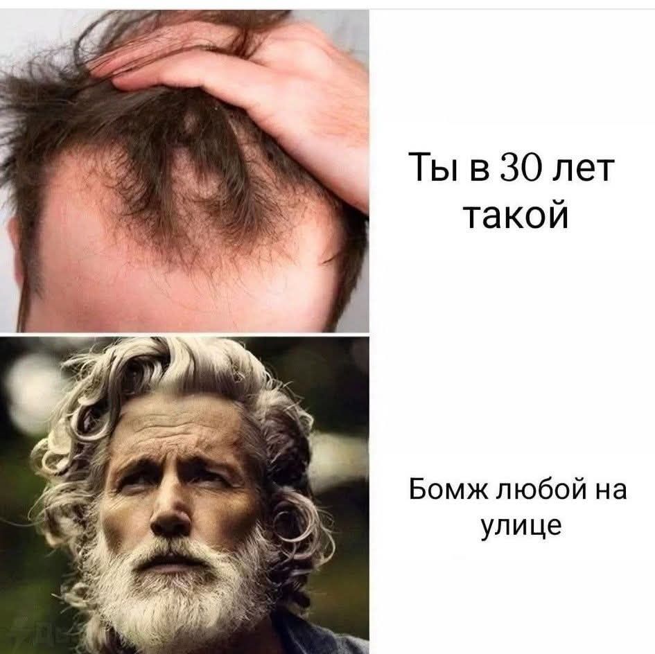 Ты в 30 лет такой. Бомж любой на улице.