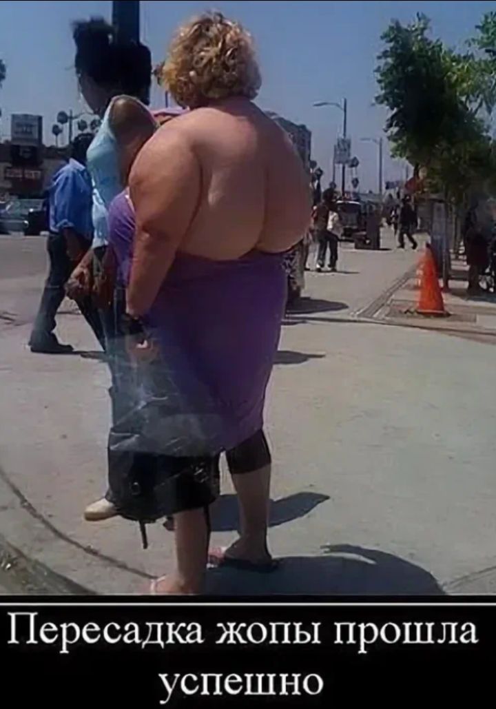 Пересадка жопы прошла успешно