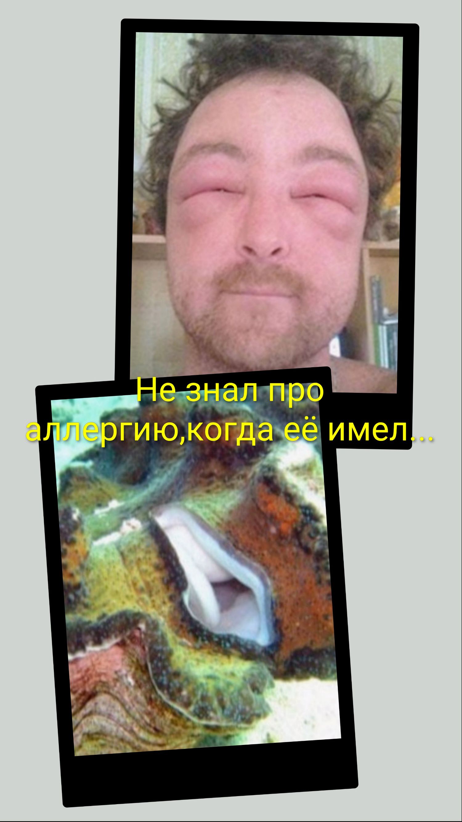 Не знал про аллергию,когда её имел...