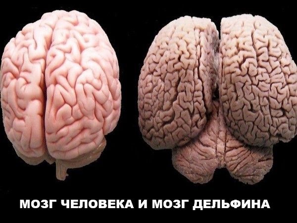 МОЗГ ЧЕЛОВЕКА И МОЗГ ДЕЛЬФИНА