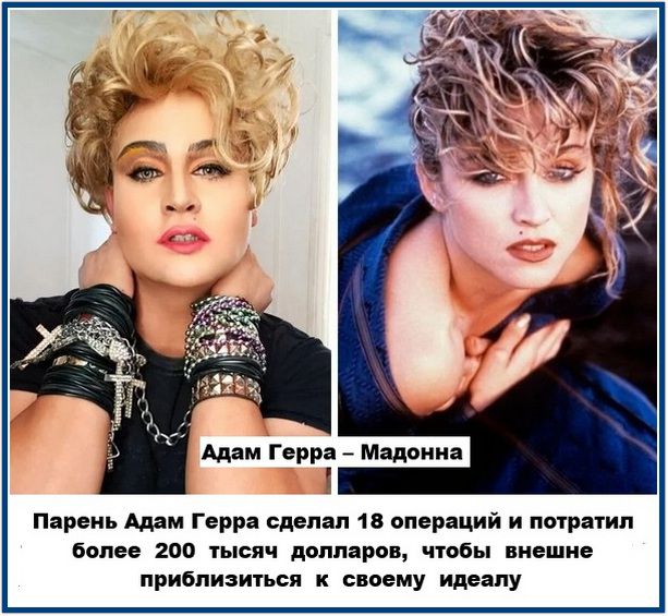 Адам Герра – Мадонна
Парень Адам Герра сделал 18 операций и потратил более 200 тысяч долларов, чтобы внешне приблизиться к своему идеалу