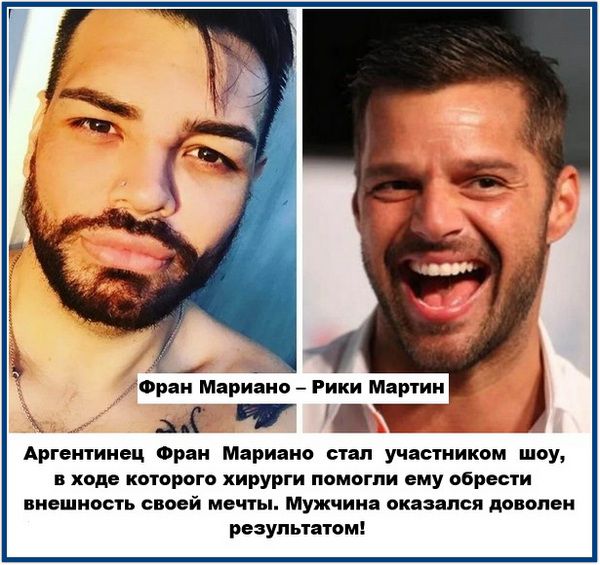 Фран Мариано – Рики Мартин Аргентинец Фран Мариано стал участником шоу, в ходе которого хирурги помогли ему обрести внешность своей мечты. Мужчина оказался доволен результатом!