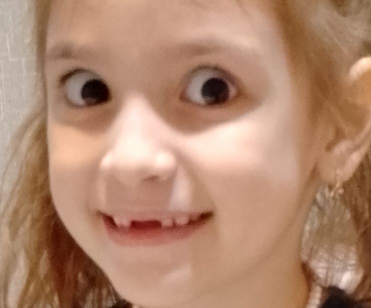 Милая девочка с широко распахнувшими глаза́ми