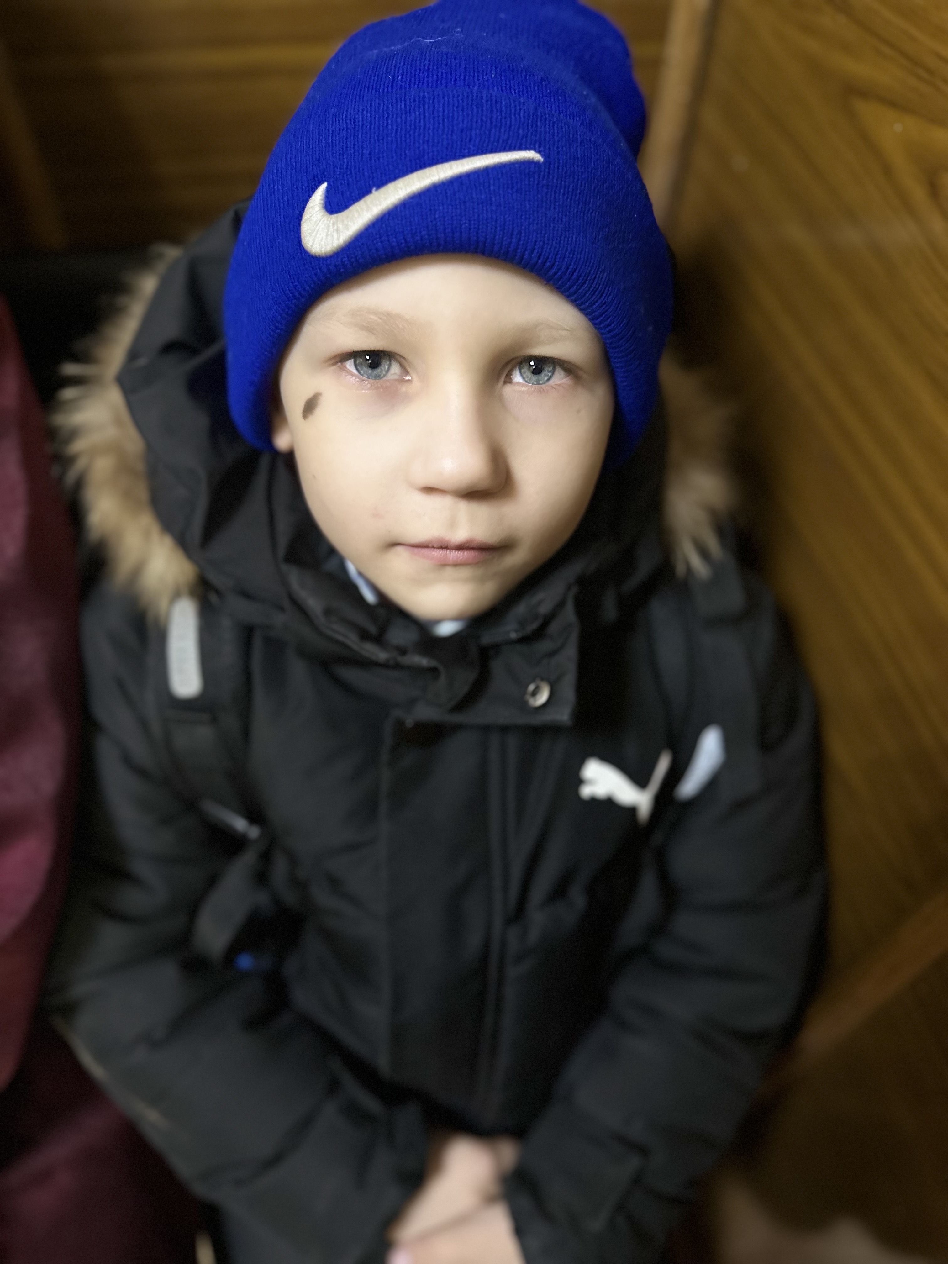 Мальчик в синей шапке и темной jackets, на лице небольшая метка/царапина.