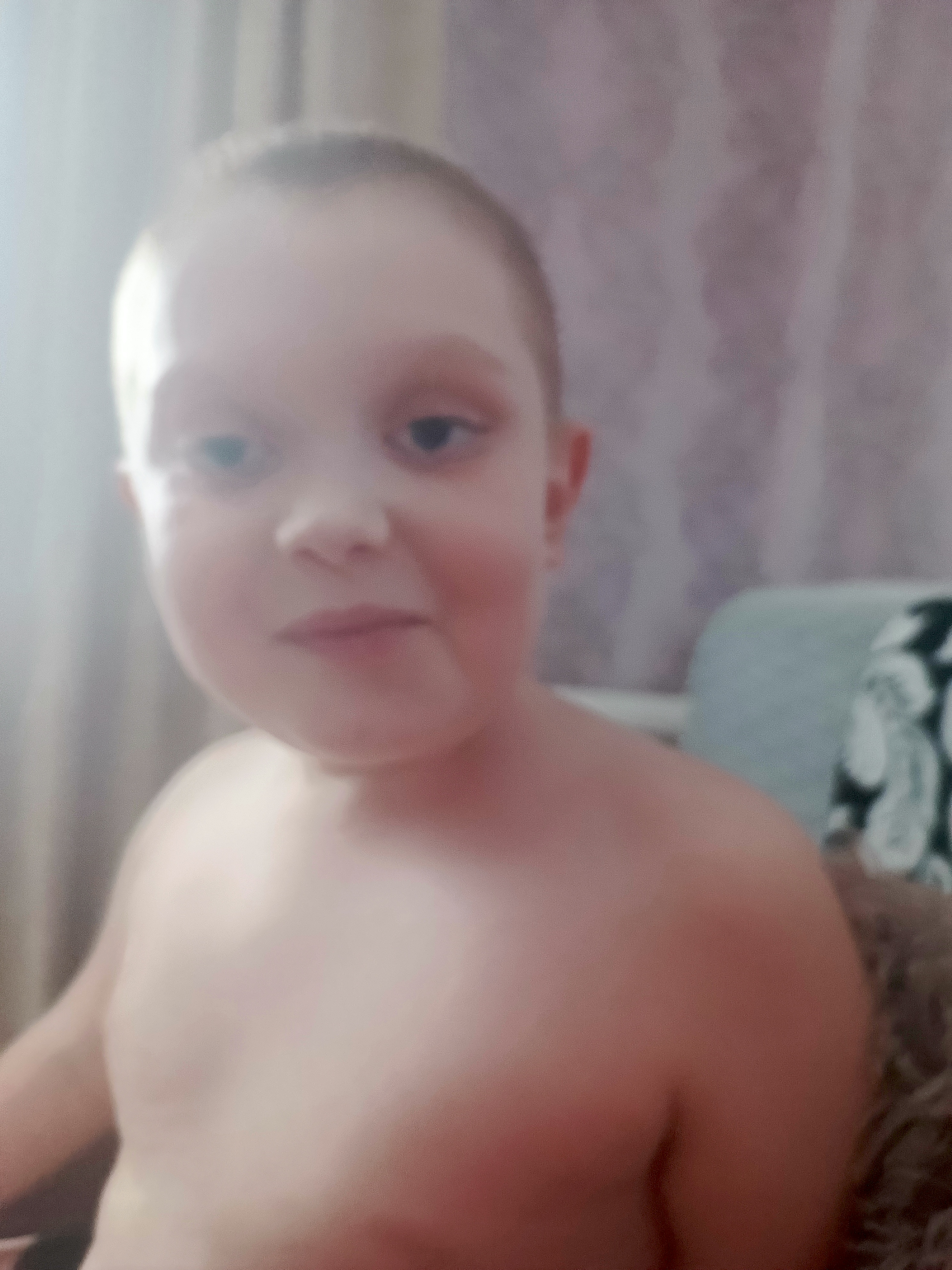 Ребёнок без футболки дома с синяками на лице.