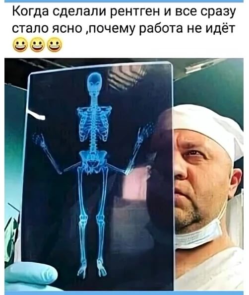 Когда сделали рентген и все сразу стало ясно ,почему работа не идёт 😂😂😂