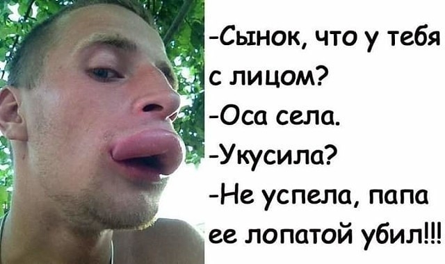 Сынок что у тебя с лицом Оса села Укусила Не успела папа ее лопатой убил