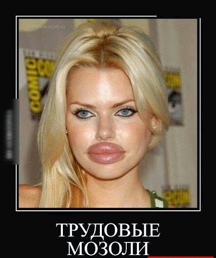 ТРУДОВЫЕ МОЗОЛИ