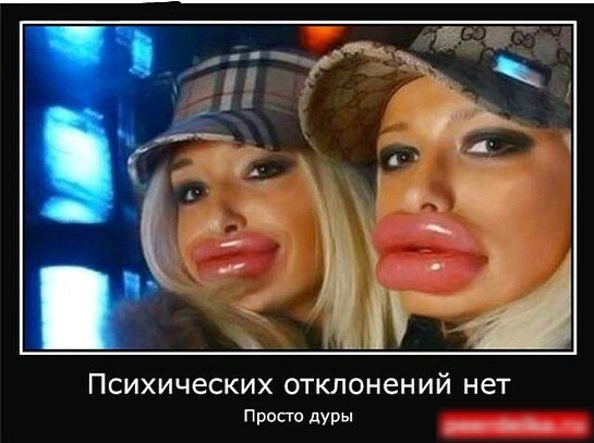ПСИХИЧЕСКИХ ОТКЛОНЕНИЙ нет Просто дуры