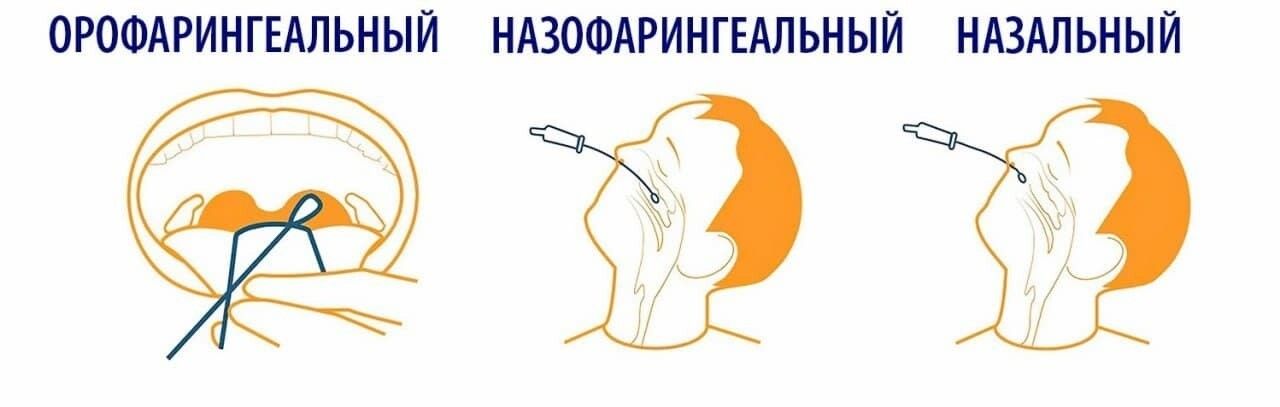 ОРОФАРИНГЕАЛЬНЫЙ НАЗОФАРИНГЕАЛЬНЫЙ НАЗАЛЬНЫЙ 1