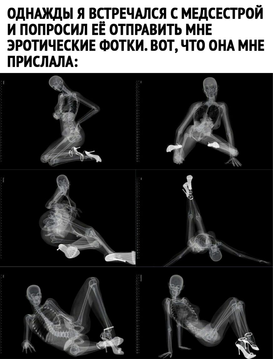 ОДНАЖДЫ Я ВСТРЕЧАЛСЯ С МЕДСЕСТРОЙ И ПОПРОСИЛ ЕЁ ОТПРАВИТЬ МНЕ ЭРОТИЧЕСКИЕ ФОТКИ ВОТ ЧТО ОНА МНЕ ПРИСЛАЛА