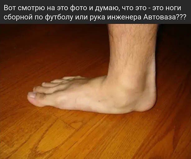 Вот смотрю на это фото и думаю что это это ноги сборной по футболу или рука инженера Автоваза