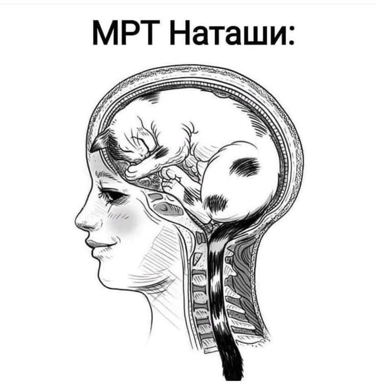 МРТ Наташи