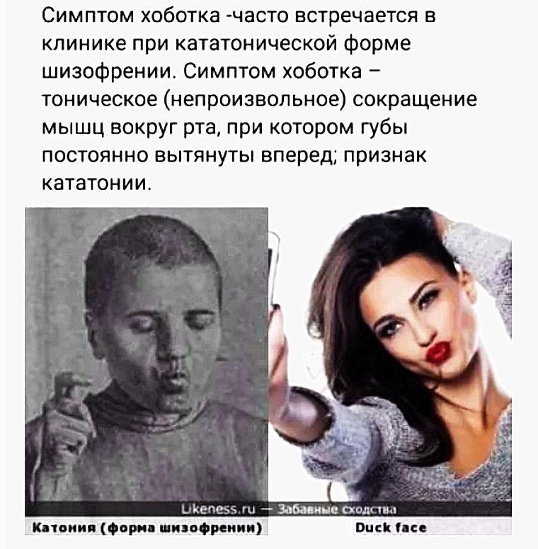 Симптом хоботка часто встречается в клинике при кататонической форме шизофрении Симптом хоботка тоническое непроизвольное сокращение мышц вокруг рта при котором губы постоянно вытянуты вперед признак кататониис инете А Забелина под пи Кпппип Форс пилиппип