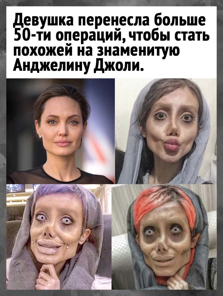 Девушка перенесла больше 50 ти операции чтобы стать похожей на знаменитую Анджелину Джоли
