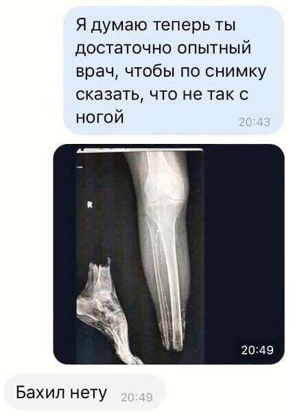 Я думаю теперь ты достаточно опытный врач чтобы по снимку сказать что не так с ногой Бахил нету