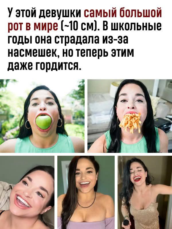 У этой девушки самый большой рот в мире (~10 см). В школьные годы она страдала из-за насмешек, но теперь этим даже гордится.