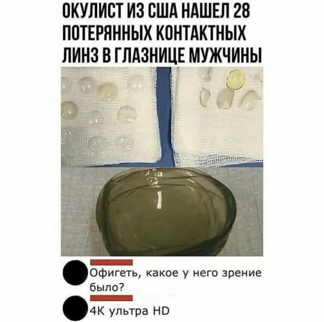 Окулорист из США нашел 28 потерянных контактных линз в глазнице мужчины. Офи геть, какое у него зрение было? 4K ультра HD