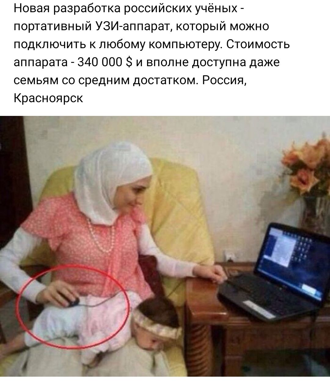 Новая разработка российских учёных портативный УЗИ аппарат который можно подключить к любому компьютеру Стоимость аппарата 340 000 и вполне доступна даже семьям со средним достатком Россия Красноярск