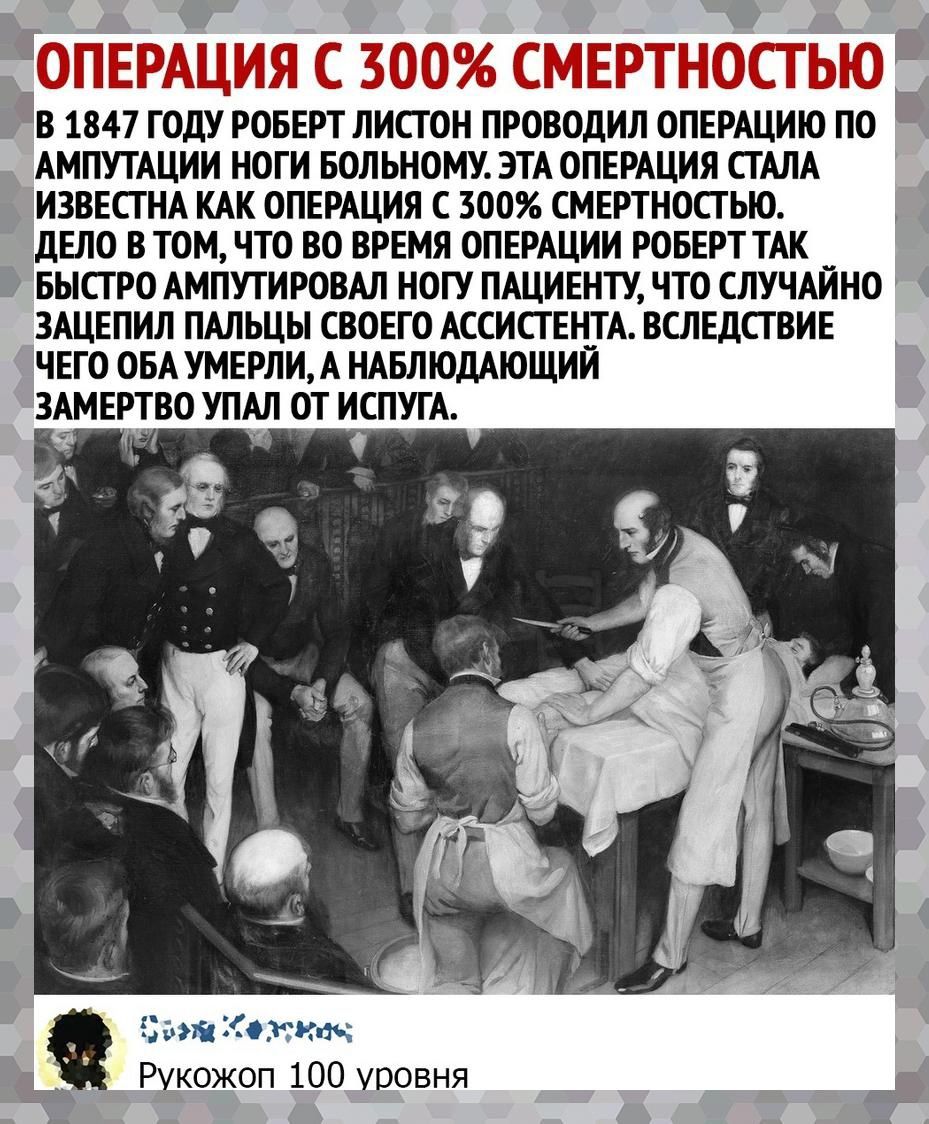 В 1847 ГОДУ РОБЕРТ ПИСТОН ПРОВОДИЛ ОПЕРАЦИТО ПО АМПУТАЦИИ НОГИ БОЛЬНОМУ ЭТА ОПЕРАЦИЯ СТАЛА ИЗВЕСТ НА КАК ОПЕРАЦИЯ С 300 СМЕРТНОСТЬЮ дЕЛО В ТОМ ЧТО ВО ВРЕМЯ ОПЕРАЦИИ РОБЕРТ ТАК __ БЫСТРО АМПУТИРОВАЛ НОГУ ПАЦИЕНТУ ЧТО СЛУЧАИНО ЗАЦЕПИЛ ПАЛЬЦЫ СВОЕГО АССИСТЕН_ТА ВСЛЕДСТВИЕ ЧЕГО ОБА УМЕРЛИА НАБЛЮДАЮЩИИ ЗАМЕРТВО УПАЛ ОТ ИСПУГА Здшіщжкпь Рукожоп 100 уровня __