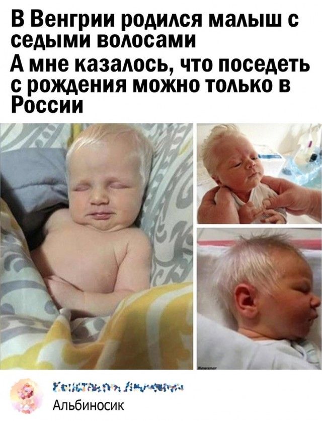 В Венгрии родился малыш с седыми воюсами А мне казалось что поседеть с рождения можно только в России А7 тайна ічдж ич Альбиносик