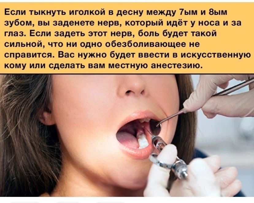 Если тыкиуть иголкой в десну между 7 и вым зубом вы задеиече нерв который идет у папа и за таз Если задеть эти нерв боль будет такий сипьипй чго ни одно пбеабппивнющее не справиуся Вас ужио будет ввести в искусственную ному или сделать вам местную анестезию
