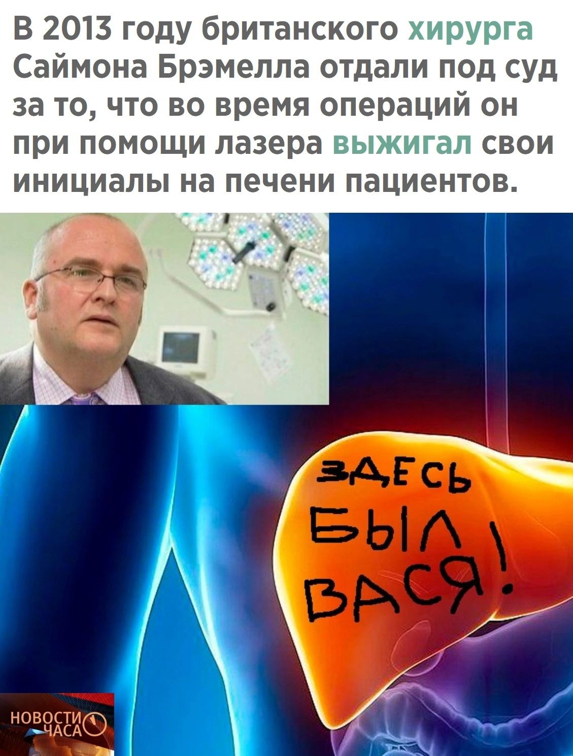 В 2013 году британского Саймона Брэмелла отдали под суд за то что во время операций он при помощи лазера свои инициалы на печени пациентов