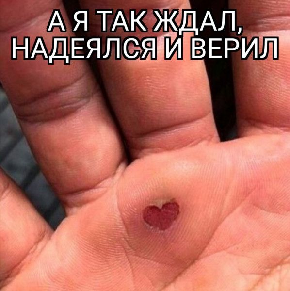 А Я ТАКіждАЛ