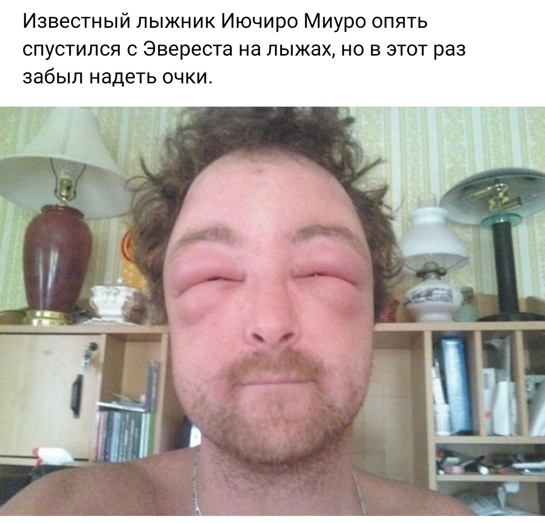 Известный лыжник Иючиро Миура опять спустился Эвереста на лыжах но в этот раз забыл надеть очки