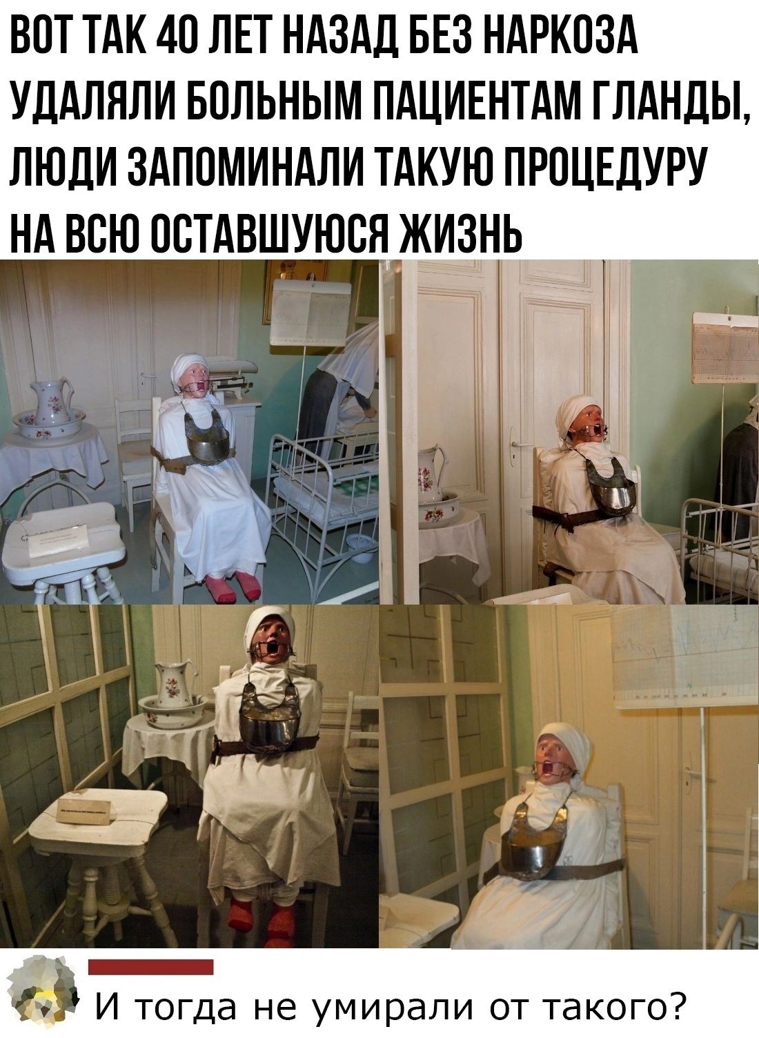 ВОТ ТАК 40 ЛЕТ НАЗАД БЕЗ НАРКПЗА УЛАЛПЛИ БОЛЬНЫМ ПАЦИЕНТАМ ГЛАНЛЫ ЛЮДИ ЗАППМИНАПИ ТАКУЮ ПРПЦЕЛУРУ НА ВСЮ ОВТАВШУЮСП ЖЁНЬ і