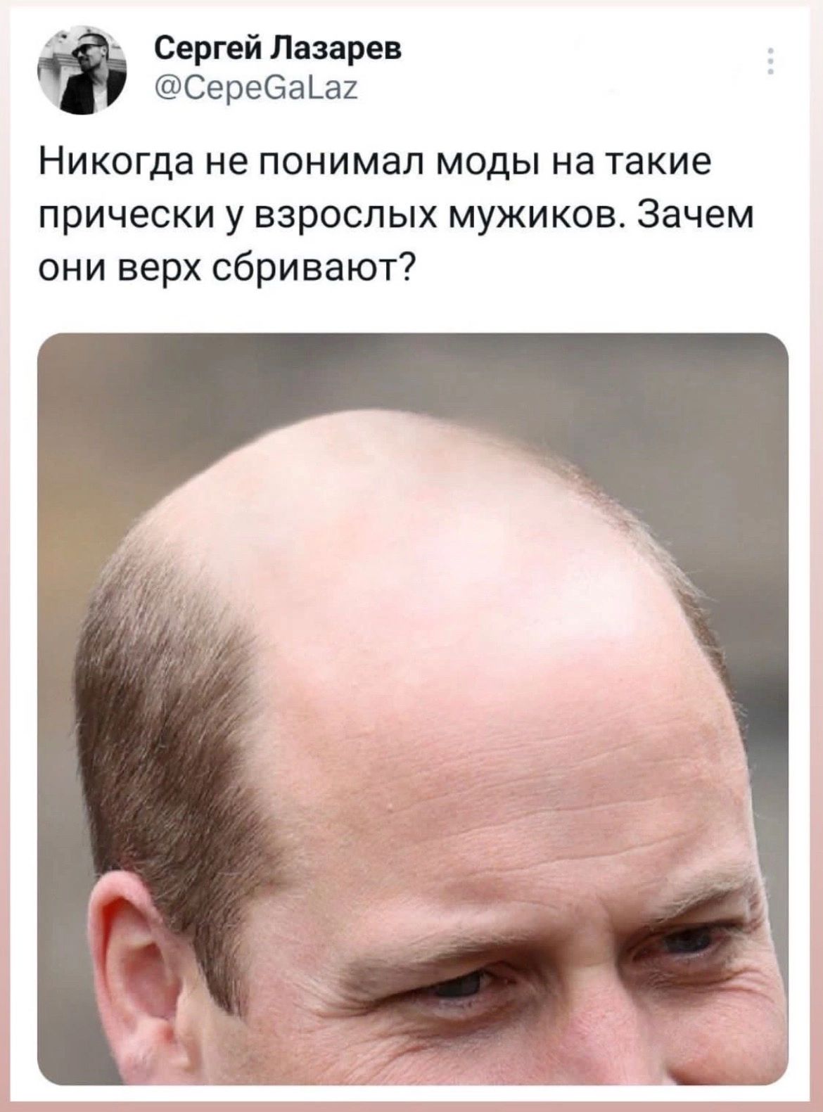 Сергей Лазаре Серееаіаи НИКОГДЗ не понимал МОДЫ На такие прически у взрослых мужиков Зачем они верх сбривают