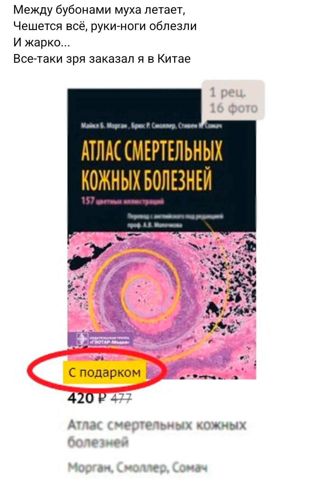 Между бубонами муха летает Чешется все рукиноги обпезпи и жарко Всетаки зря заказал я в Китае