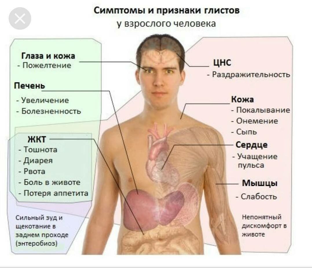 сыпь при глистах у детей фото